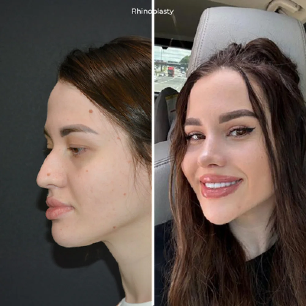 Наиболее предпочтительные пластические операции по возрасту