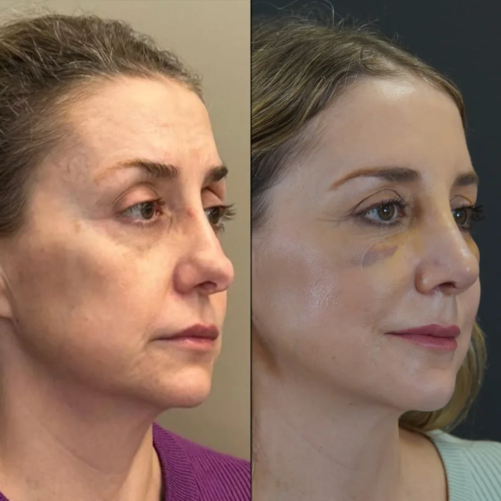 Preise für plastische Chirurgie in der Türkei 2025: Umfassender Leitfaden für internationale Patienten